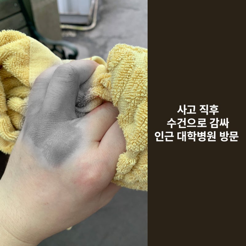날카로운 것에 찢어졌을 때 응급처치, 봉합, 피부이식, 흉터 관리까지 기린성형외과