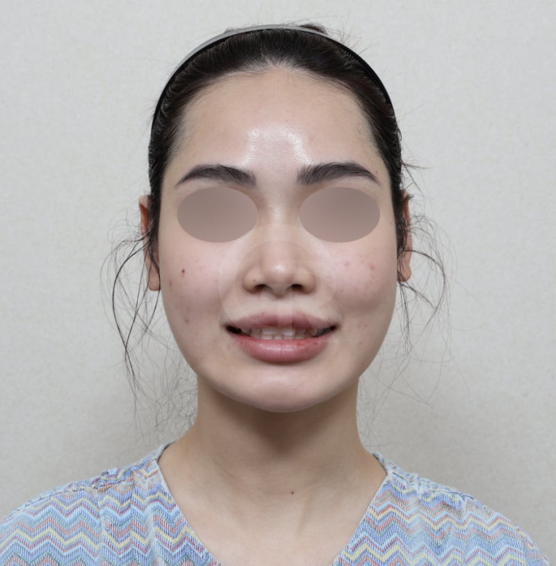 얼굴이 넓어 보이는 이유, 비대칭이 원인일 수 있습니다