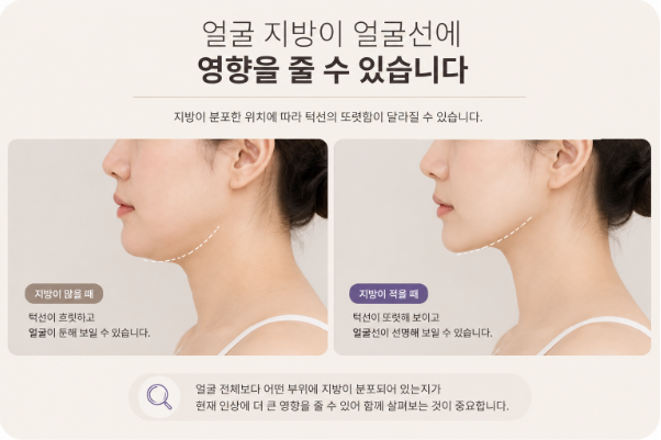 갸름주사, 얼굴살이 안 빠져 고민이라면