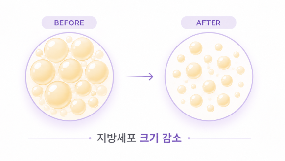 지방분해주사란? 효과와 얼굴 적용 부위 알아보기 사진 3