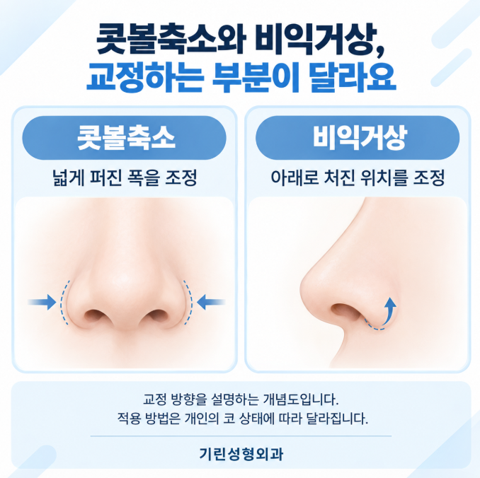 비익거상, 코수술할 때 처진 콧볼을 함께 보는 이유 사진 5